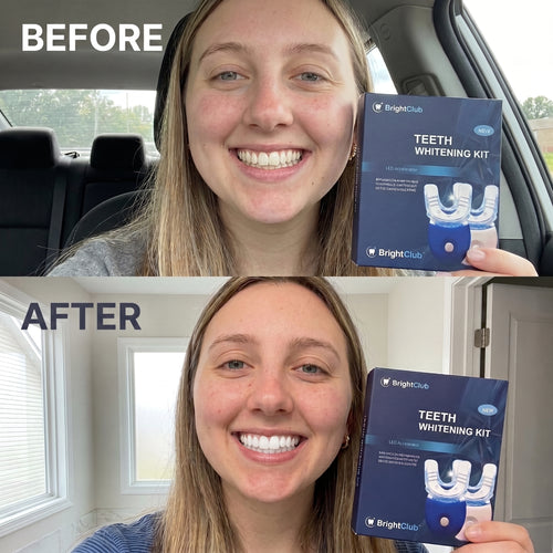BrightClub Teeth Whitening Kit